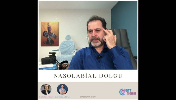 nasolabial-dolgu